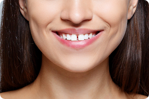 can braces fix gaps in teeth in midwest city ok